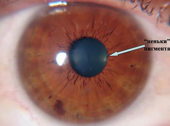 ris10