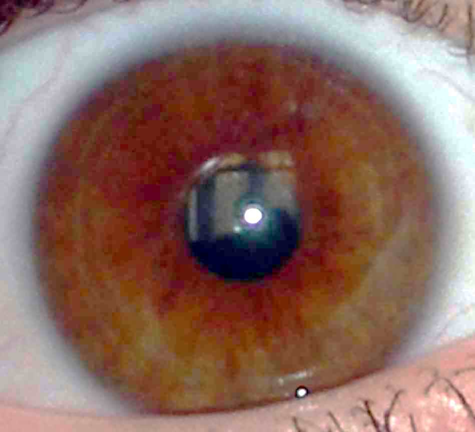 ris15