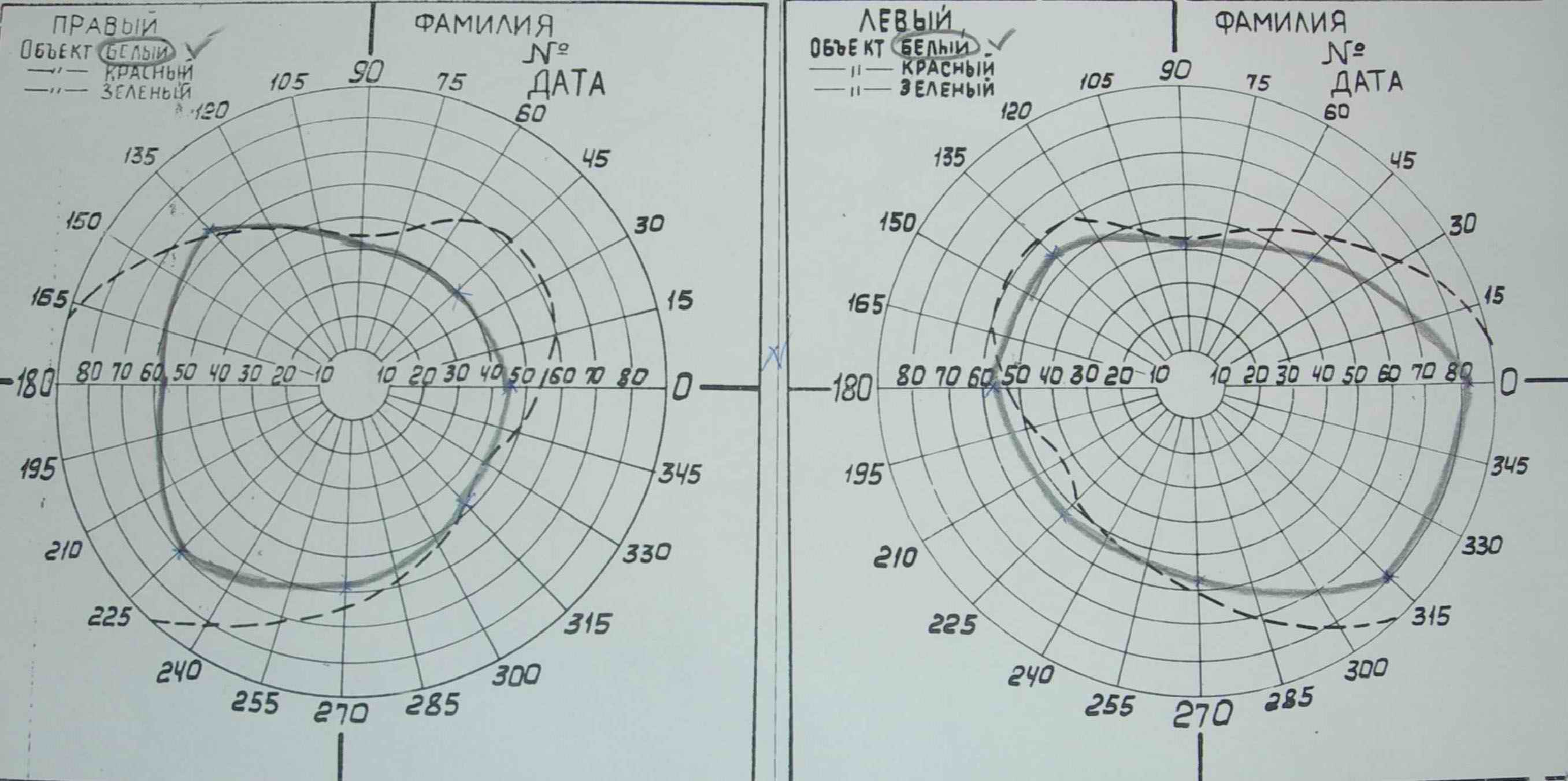 ris18